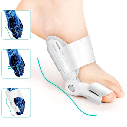 Bunion Splint and Big Toe Straightener – Orthopedic Hallux Valgus Corrector for Foot Pain Relief & Pedicure Care